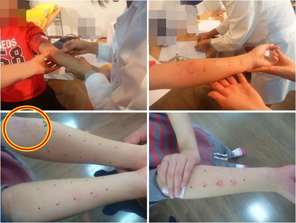 [불평등식판 반대] 아동생활시설 대상 최초 ‘건강영향평가’ 연구를 시작합니다 썸네일 이미지