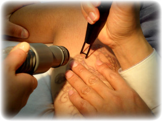 [문신제거] 한 달에 한 번! 유쾌한 수다현장! 썸네일 이미지